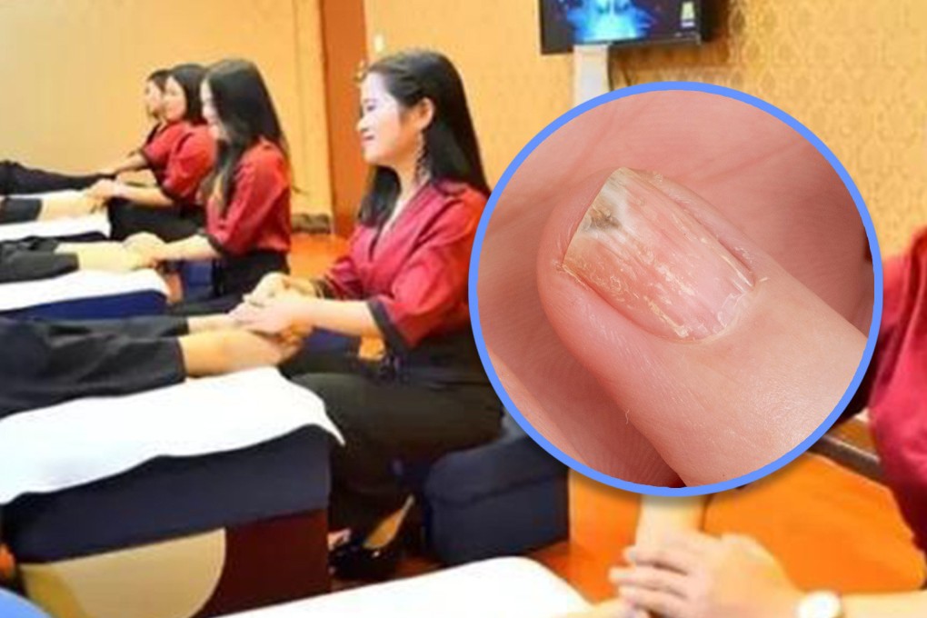 A foot massage centre in China has been ordered to compensate a four-year-old boy and his father after the youngster had to have his finger amputated following treatment for a nail infection that went wrong. Photo: SCMP composite/Shutterstock/Sohu