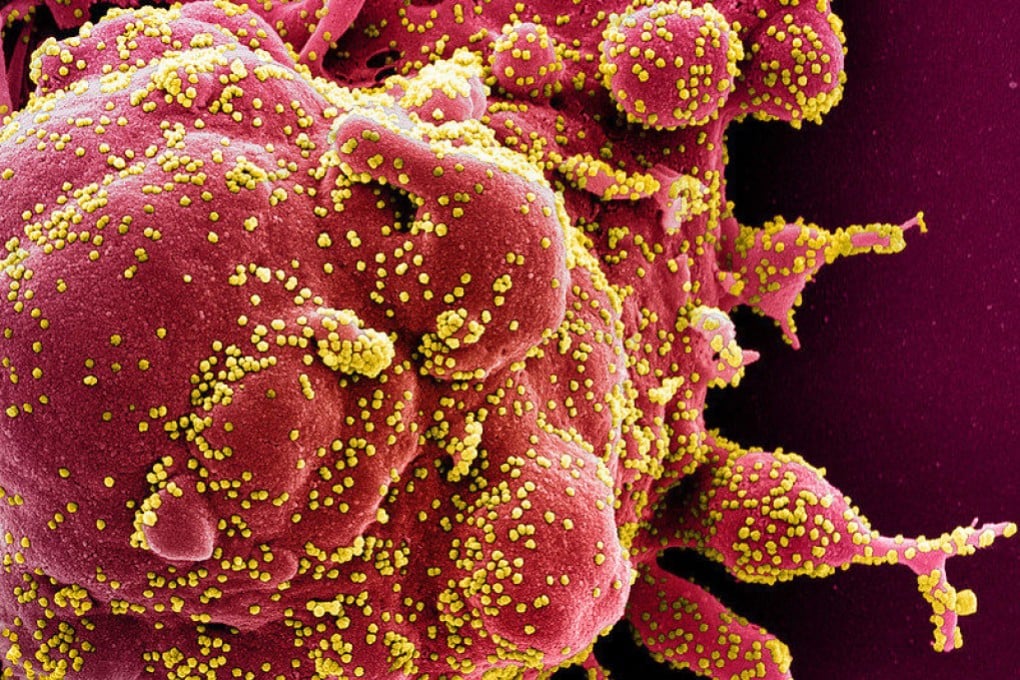 A team of scientists in mainland China, Hong Kong and Australia have used AI to accelerate virus discovery after previous methods could not identify this “dark matter”. Photo: AFP/ National Institute of Allergy and Infectious Diseases, NIH