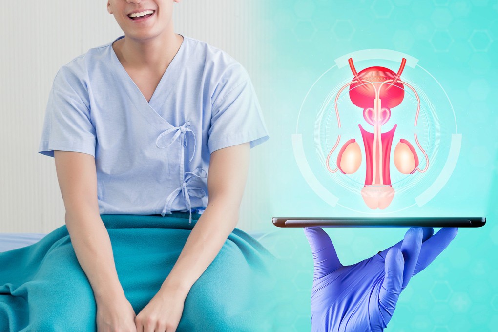 Young men in China are sharing their experiences of vasectomy in a trend that is being seen as fostering a “new good man’” image. Photo: SCMP composite/Shutterstock
