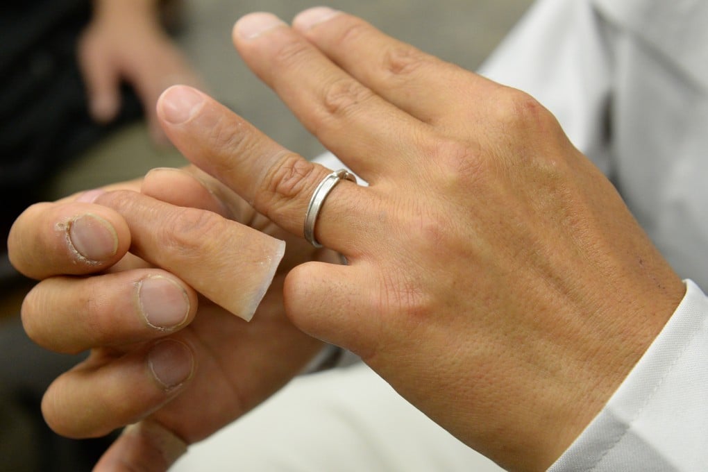 A former yakuza gangster shows off his silicone-made finger for a chopped off finger. “Yubitsume” is a ritual in Japan’s underworld whereby a yakuza amputates a part of their little finger to express a sincere apology for a transgression. Photo: AFP