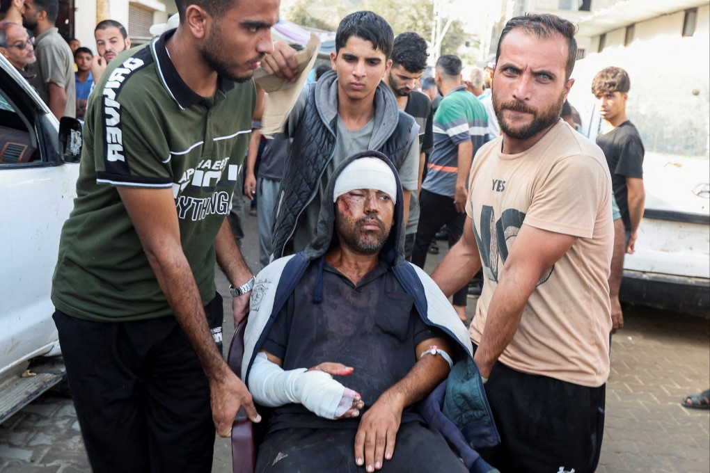 A man who was wounded in an Israeli strike on tents sheltering displaced people in central Gaza. Photo: Reuters