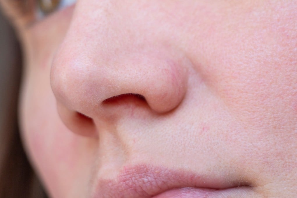 Scientists in China studies the nasal biome of nearly 1,600 healthy young adults and said they identified “extensive sex differences in the respiratory tract community”. Photo: Shutterstock