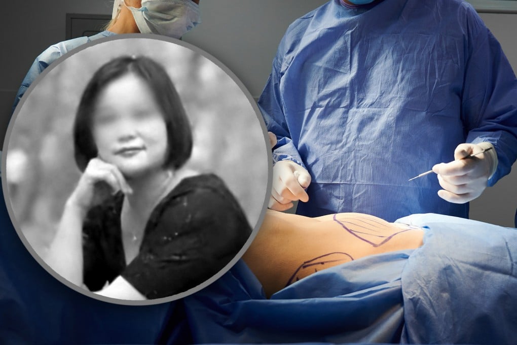 A woman in China has died after she had six cosmetic surgery procedures over 24 hours. Photo: SCMP composite/Shutterstock/Douyin