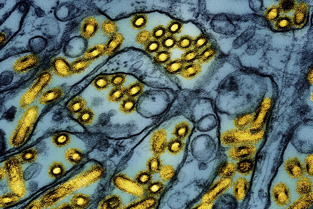 Avian influenza A H5N1 virus particles. Photo: CDC/NIAID via AP