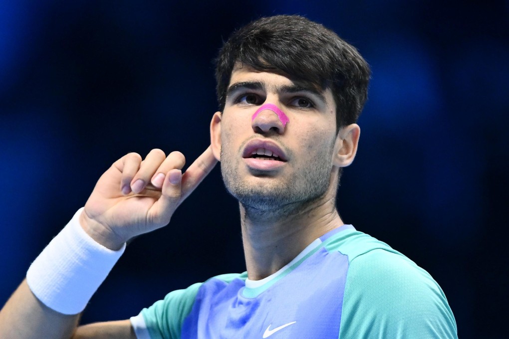 Spain’s Carlos Alcaraz, who had to abandon a practice session on Tuesday, said “I did surprise myself” with his performance. Photo: EPA-EFE