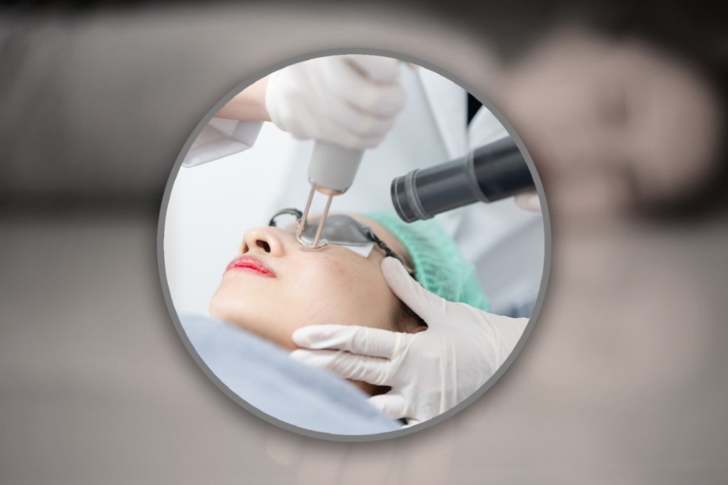 A woman in China died 10 days after laser treatments for spot and birthmark removal, raising concerns about cosmetic procedure safety. Photo: SCMP composite/Shutterstock