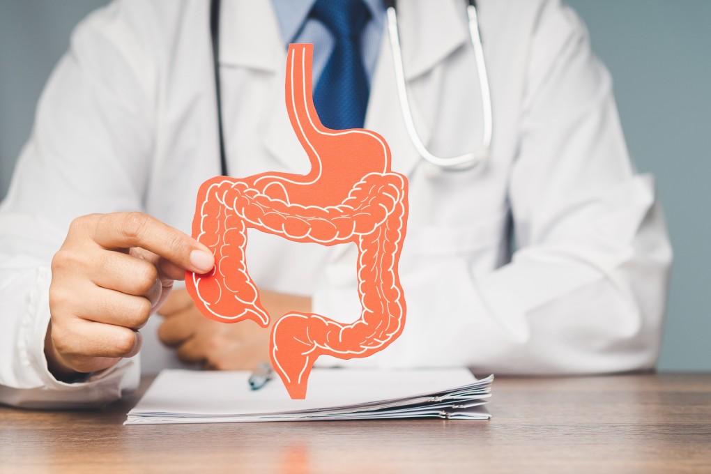 Patients currently have to undergo multiply colonoscopies to detect inflammable bowel disease, with such procedures costing about more than HK$65,000. Photo: Shutterstock