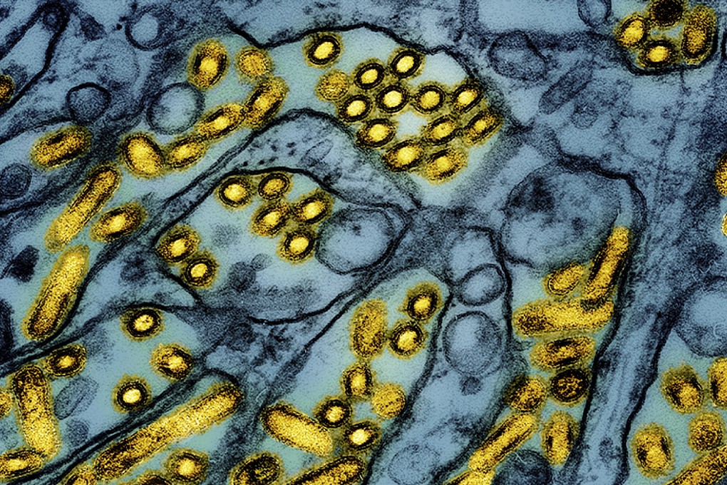 This colourised electron microscope image shows avian influenza A H5N1 virus particles (yellow). File photo: CDC/NIAID via AP