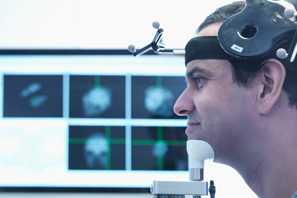 Transcranial magnetic stimulation (TMS) stimulates and resets specific areas of the brain to provide relief from OCD symptoms. Photo: Shutterstock
