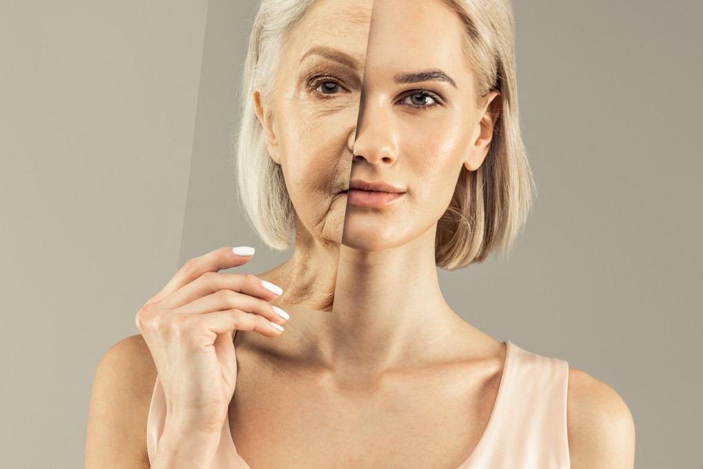 A specially designed diet and a lifestyle programme helped six women in a study lower their chronological age b years in a matter of weeks. Photo: Shutterstock