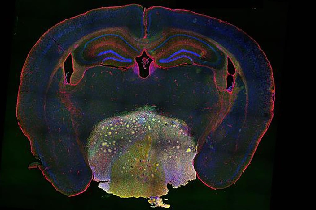 Craniopharyngioma, shown here in the brain of a mouse, can cause symptoms including obesity, diabetes, visual effects and decreased hormone secretion in humans affected by the tumour. Photo: Chinese Academy of Sciences Institute of Genetics and Developmental Biology