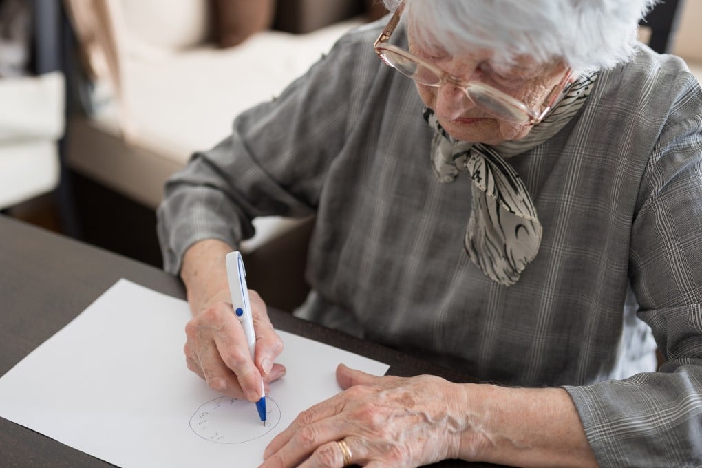 The clock-drawing test requires a person to be able to interpret the placement of the hands in relation to the numbers. It is an ability often lost in people with early dementia. Photo: Shutterstock
