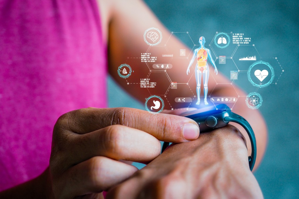 Three global fitness trends in 2025 have been spotted by the American College of Sports Medicine. One is advances in wearable tech. Photo: Shutterstock