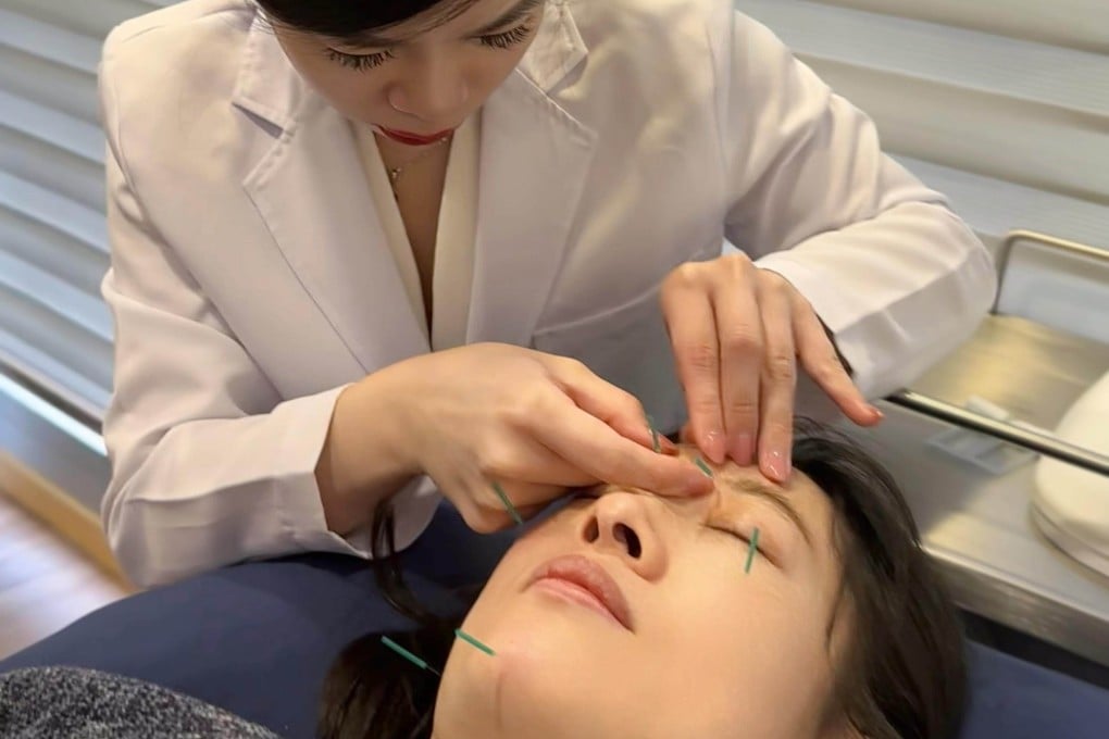 TCM practitioner Elizabeth Yau gives a patient facial acupuncture. Acupuncture has become a common TCM treatment. Photo: Elizabeth Yau