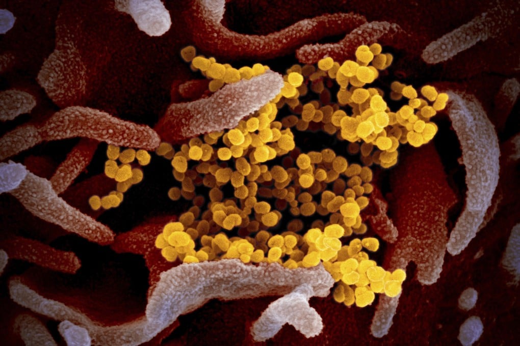 An electron microscope shows the coronavirus, in yellow, emerging from the surface of cells. Image: NIAID-RML via AP