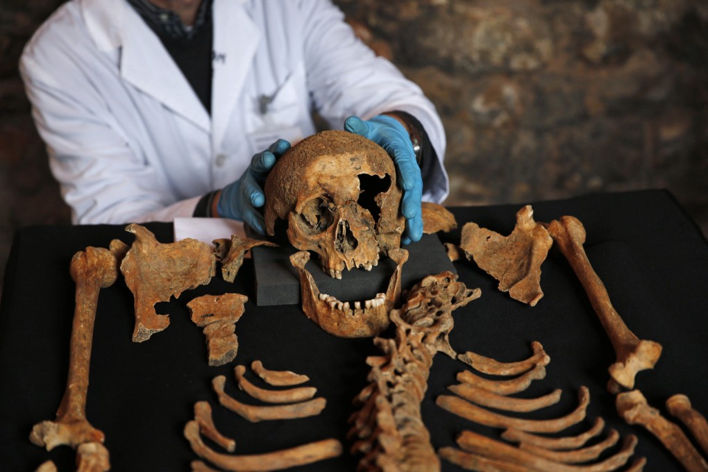 One of 25 skeletons found by construction workers in central London, in 2014, suspected to be from a cemetery for victims of the Black Death in the 14th century. Such finds can yield clues about ancient diseases. Photo: AP