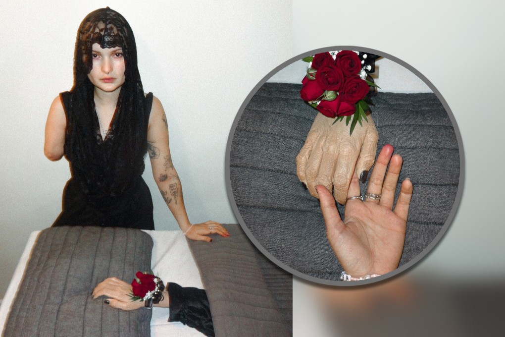A social media influencer in the US who had her right arm amputated as a result of cancer has held an unusual funeral ceremony for her lost limb. Photo: SCMP composite/IG@semibionicbarbie
