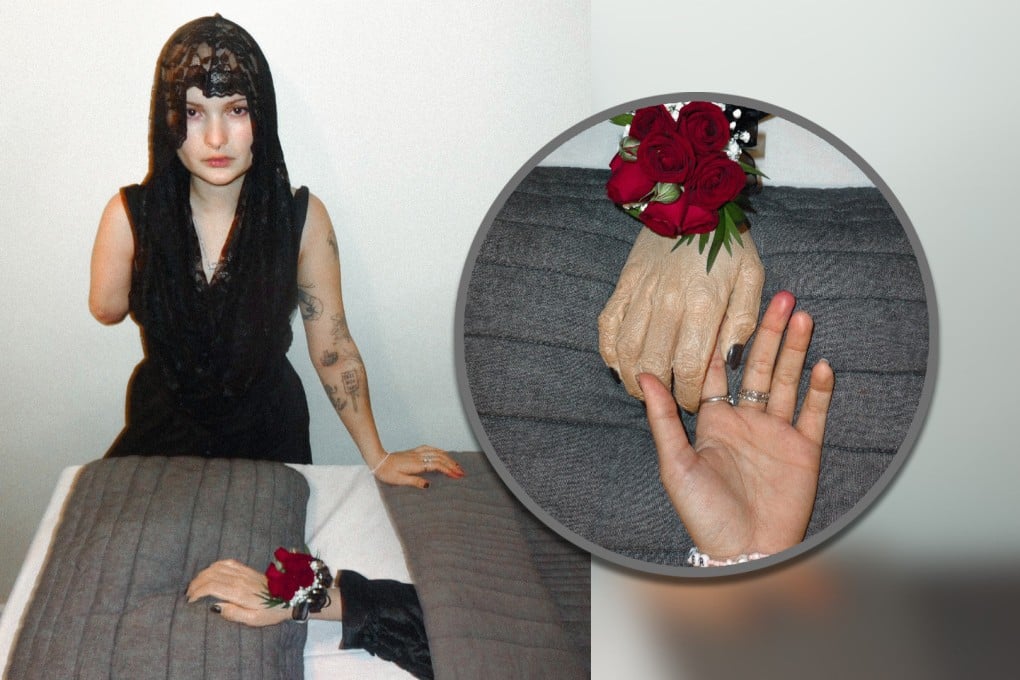 A social media influencer in the US who had her right arm amputated as a result of cancer has held an unusual funeral ceremony for her lost limb. Photo: SCMP composite/IG@semibionicbarbie