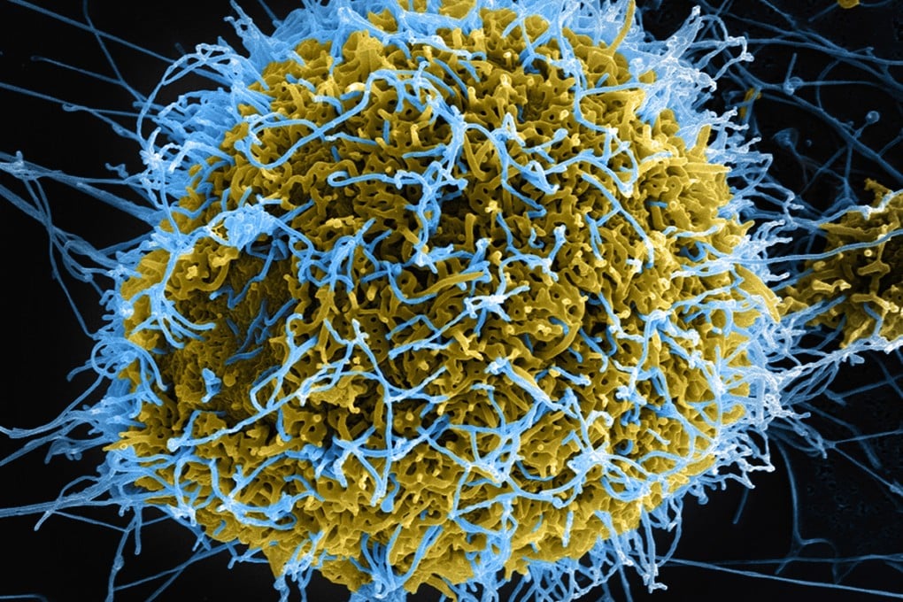 Ebola virus particles (blue) forming from an infected VERO E6 cell (yellow). Photo: Getty Images/Cultura RF