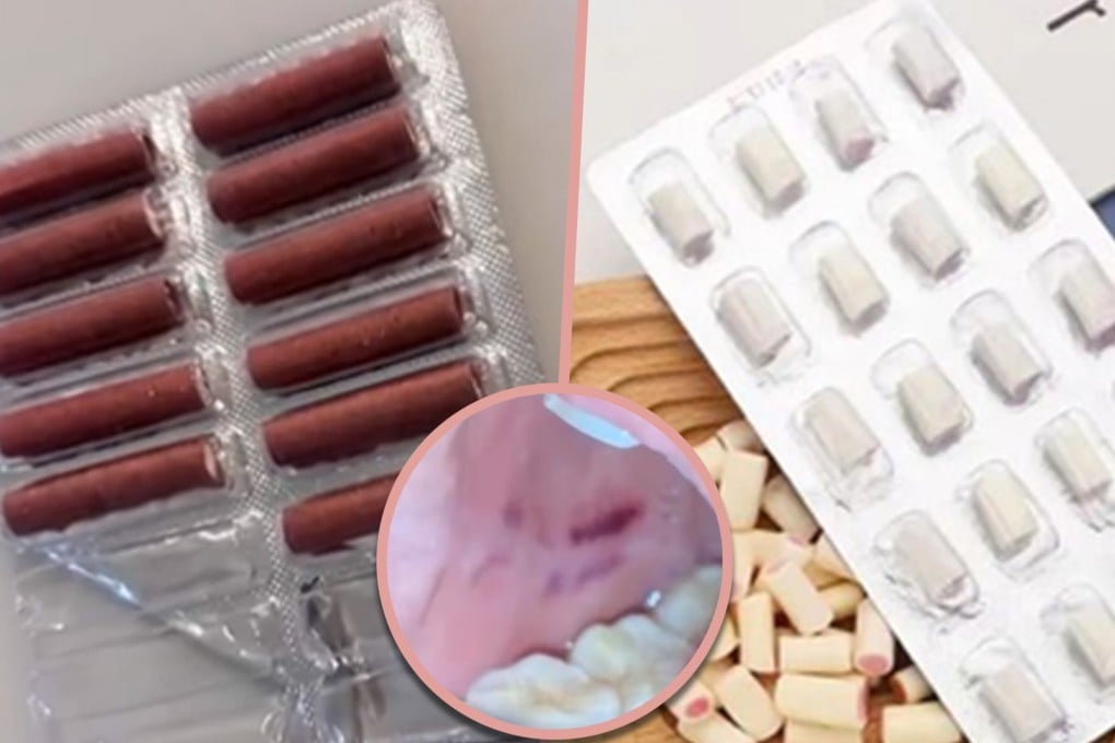 A Chinese woman sustained injuries after mistakenly biting into a firecracker, believing it to be candy.
Photo: SCMP composite/Douyin