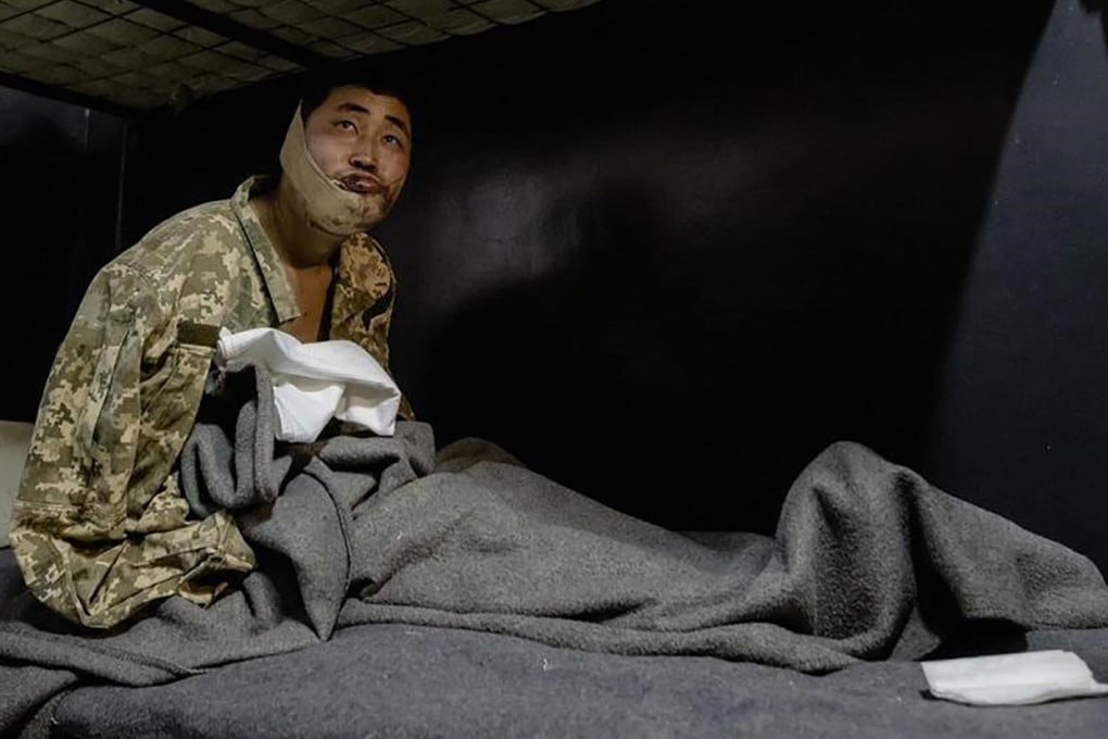 A North Korean soldier, known simply as Ri, after his capture by Ukrainian forces in January. Photo: Telegram/V_Zelenskiy_official/AFP