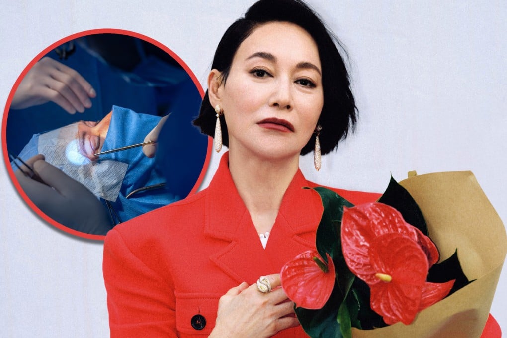 Hong Kong actress and action star Hui Ying-hung has revealed that she had to have 89 stitches in her face as a result of injuries suffered in fight scenes. Photo: SCMP composite/Weibo/Shutterstock