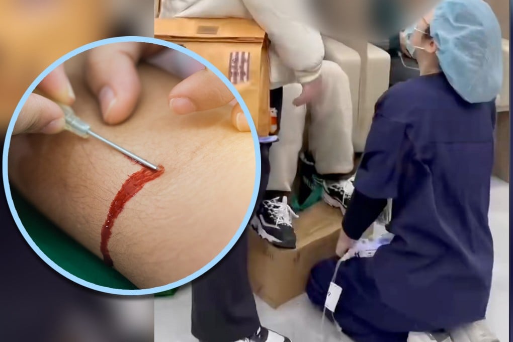 A nurse in China knelt to express her apologies to a patient for post-procedure bleeding, garnering 100 million views online in a surge of sympathy. Photo: SCMP composite/Shutterstock/Douyin