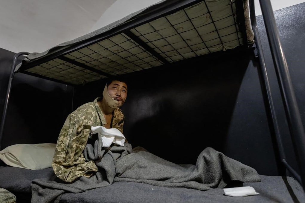 This undated handout photograph released on January 11 shows an alledged North Korean soldier detained by authorities in Ukraine. Handout photo: Telegram/V_Zelenskiy_official/AFP