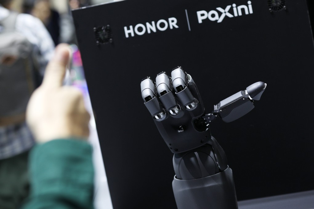 A visitor interacts with a robot hand during the 2025 Mobile World Congress in Barcelona, Spain, on March 3, 2025. Photo: Xinhua