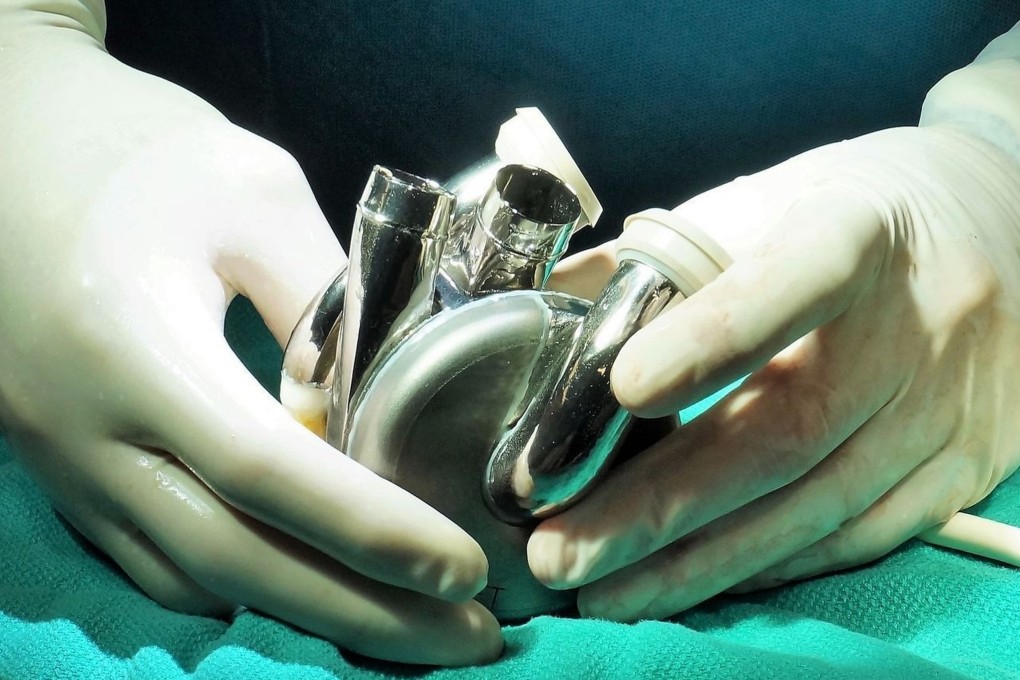 A BiVacor artificial heart. Its makers say the long-term goal is for patients to live with the device indefinitely without needing a transplant. Photo: BiVacor