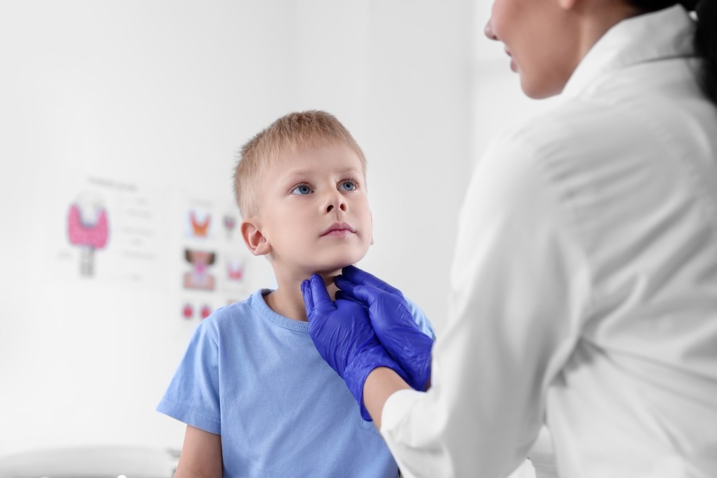 One sign of not having enough iodine is a swelling of the neck, known as a goitre. Photo: Shutterstock