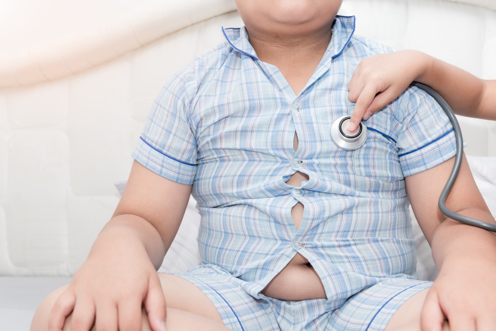 Childhood obesity is a rising problem in Hong Kong. Photo: Shutterstock