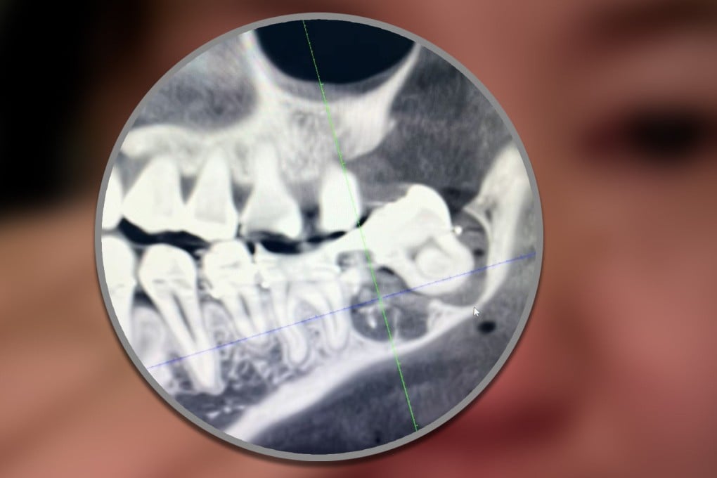 A woman in China who suffered “immense” pain after a botched tooth extraction has died after plunging from a hospital roof. Photo: SCMP composite/Douyin