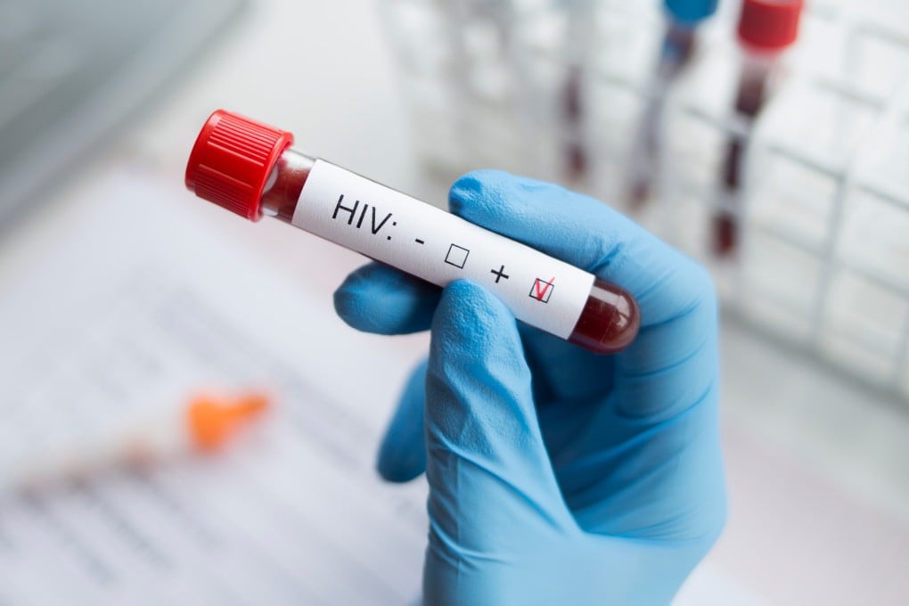 A diagnostician holds a positive HIV test. Photo: Shutterstock