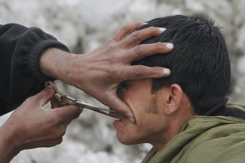 An Afghan street barber trims the mustauche of a customer in Kabul. Photo: AP