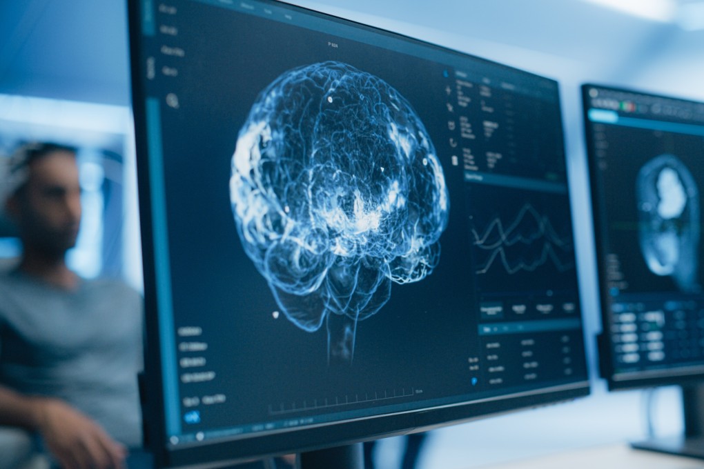 Pemetaan Claustrum Monyet Buka Rahasia Otak dan Kesadaran