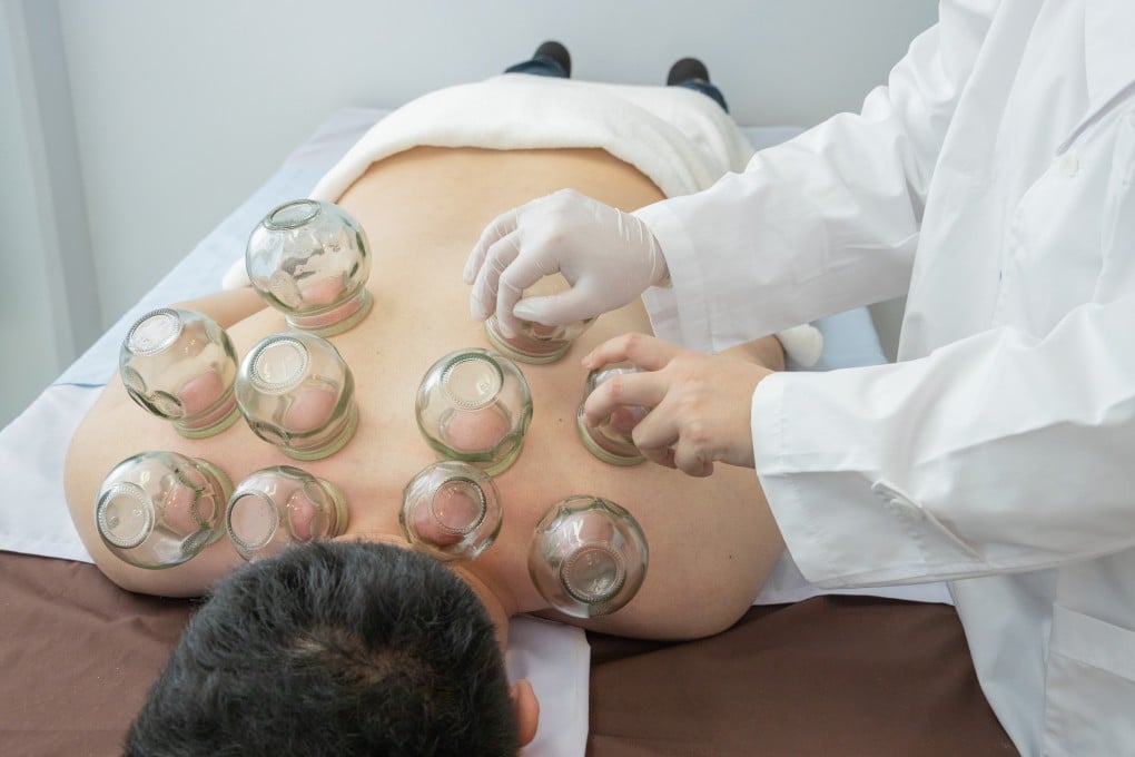 Cupping is one method often used in TCM to alleviate symptoms of “damp” illness. Two Hong Kong-practitioners share more tips about how to protect your health. Photo: Shutterstock