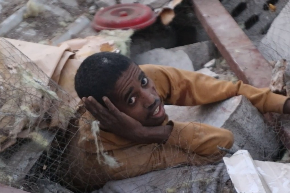 A wounded African migrant who was at the detention facility allegedly struck by the US. Photo: Al-Masirah TV via EPA-EFE