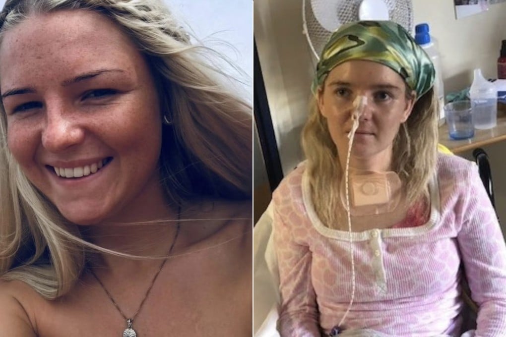 She could not recognise her mother, but Summer Clarke could sing her favourite songs while recovering from a stroke. She is not the only one. Photo: Summer Clarke