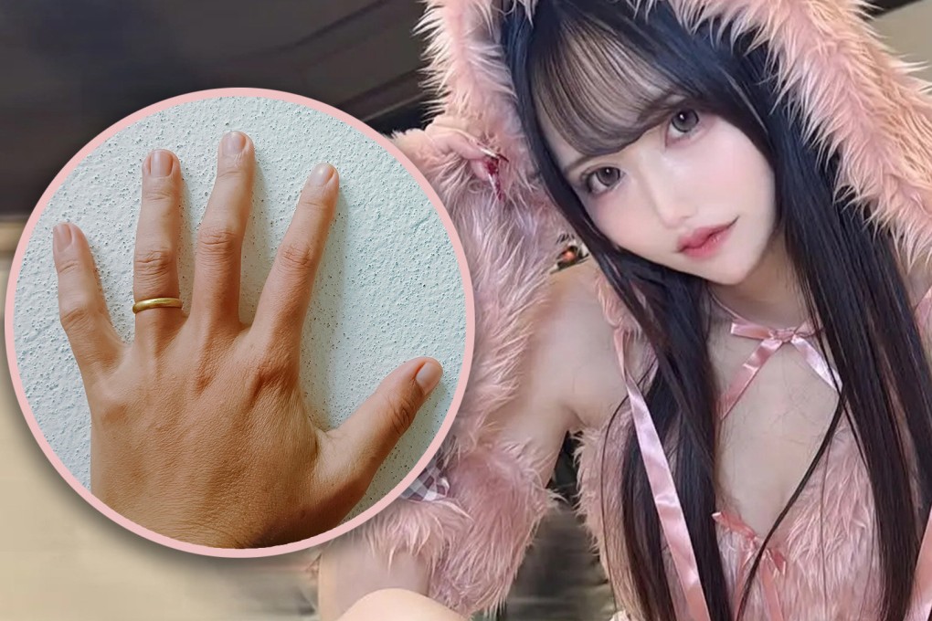A Japanese woman has been arrested after she cut off her boyfriend’s ring finger to prevent him from marrying someone else. Photo: SCMP composite/Shutterstock/IG@oreno_eromanga