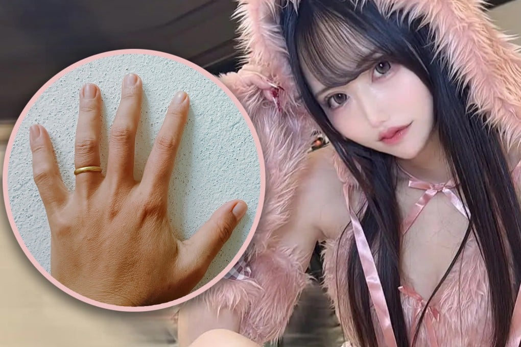 A Japanese woman has been arrested after she cut off her boyfriend’s ring finger to prevent him from marrying someone else. Photo: SCMP composite/Shutterstock/IG@oreno_eromanga