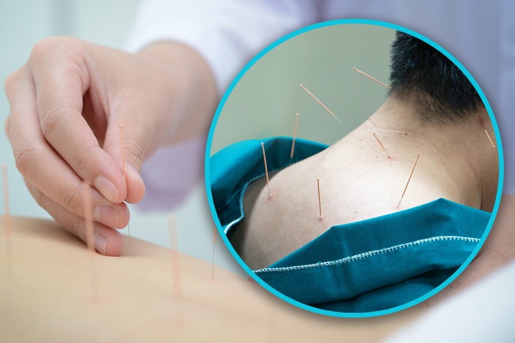 A man in China placed his trust in an unqualified doctor to treat a benign tumour and almost died as a result. Photo: SCMP composite/Shutterstock