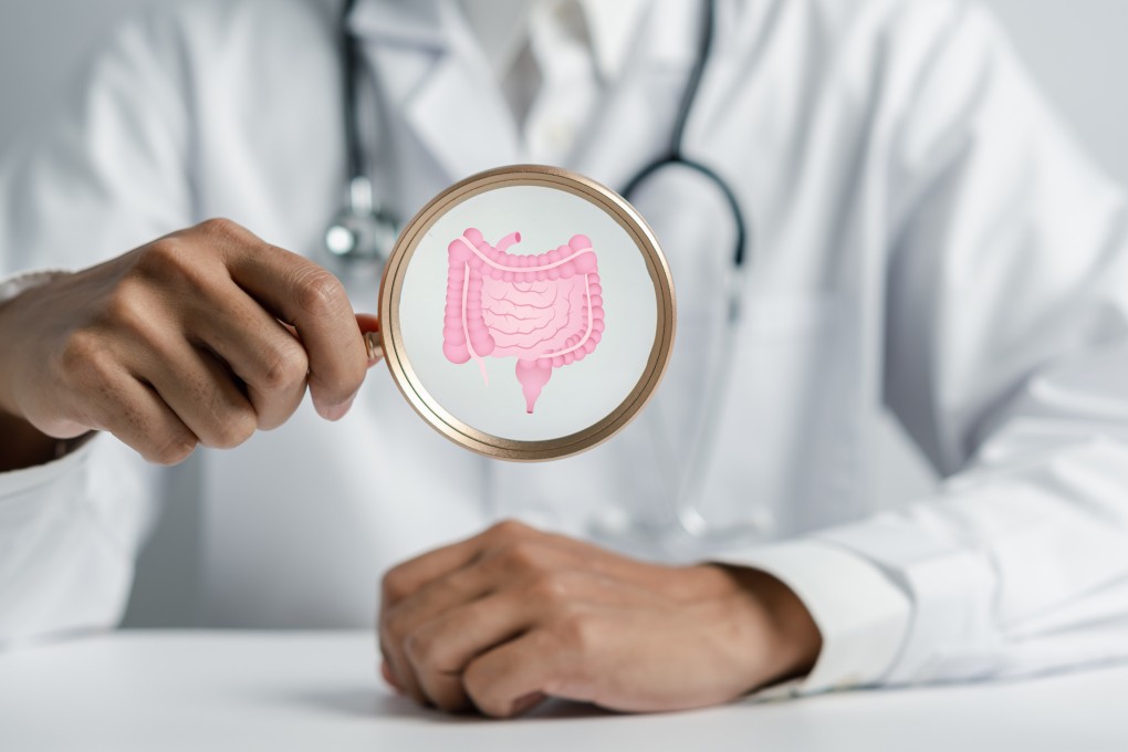 Inflammatory bowel disease refers to a group of conditions that cause swelling and inflammation of tissues in the digestive tract. Photo: Getty Images
