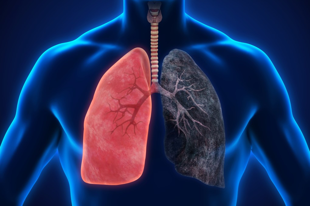 The lungs will filter out tar inhaled from cigarettes, but much of it builds up, turning lungs black instead of a healthy pink – leading to lung disease, including cancer. Smoking affects various other organs in our body in different ways. Illustration: Shutterstock