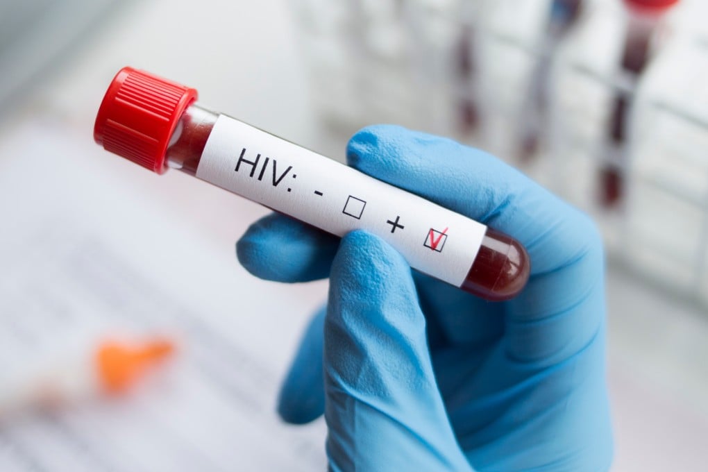 A diagnostician holds a positive HIV test. Photo: Shutterstock