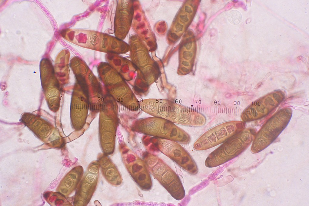 Fungal spores that can cause plant disease are viewed under a microscope. A case of alleged smuggling of a pathogen into the US has renewed concerns about a further talent exodus from the country