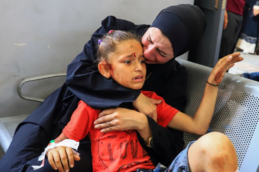 A Palestinian girl, wounded in an Israeli strike, receives treatment at Al-Shifa hospital in Gaza City. Photo: Reuters
