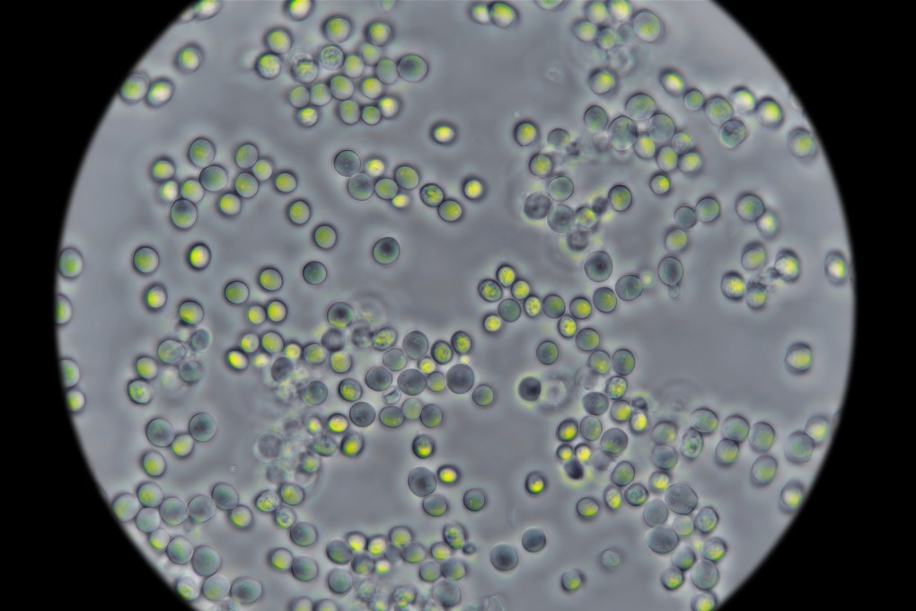 Yeast seen under a microscope. Using a mathematical analysis, Chinese researchers have unlocked new insights about cell metabolism by studying yeast. Photo: Shutterstock