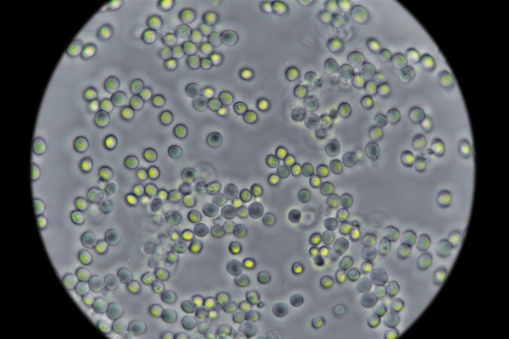 Yeast seen under a microscope. Using a mathematical analysis, Chinese researchers have unlocked new insights about cell metabolism by studying yeast. Photo: Shutterstock