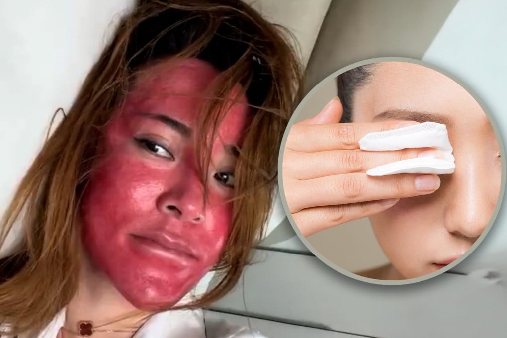 Bahaya Memakai Make-up 22 Tahun Tanpa Membersihkan, Wajah Terluka Parah